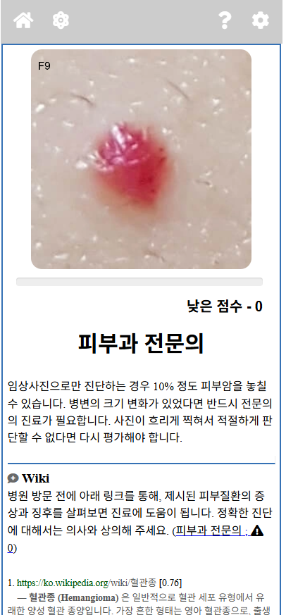 ModelDerm 어플리케이션 사용 화면. 피부 병변 사진을 업로드하면 알고리즘이 질환을 구분한다. ModelDerm 어플리케이션 사용 화면. 피부 병변 사진을 업로드하면 알고리즘이 질환을 구분한다.